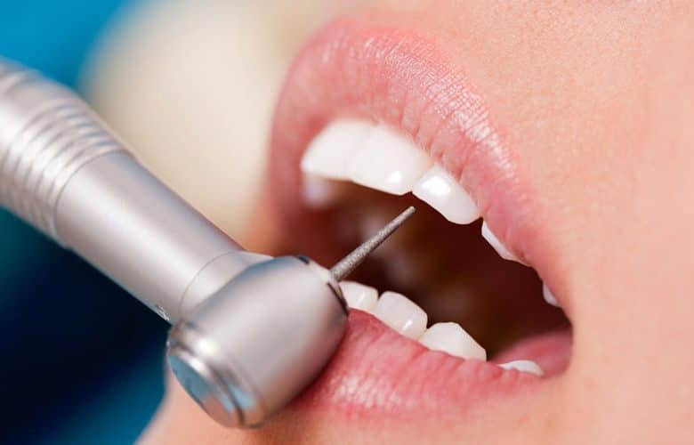 Diş Tedavilerinde İlk Muayenin Önemi Kanıtlandı!