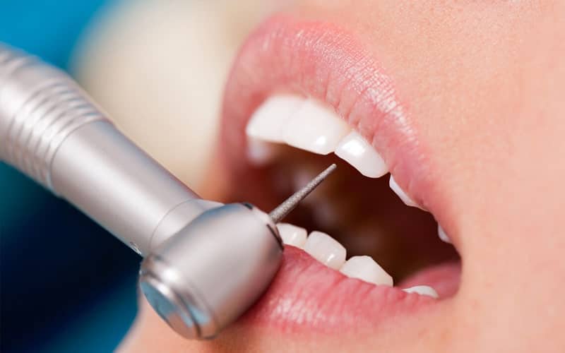 Diş Tedavilerinde İlk Muayenin Önemi Kanıtlandı!